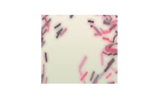Pathology Transcription Service