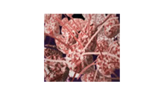 Oncology Transcription Service