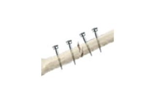 Orthopedic Transcription Service